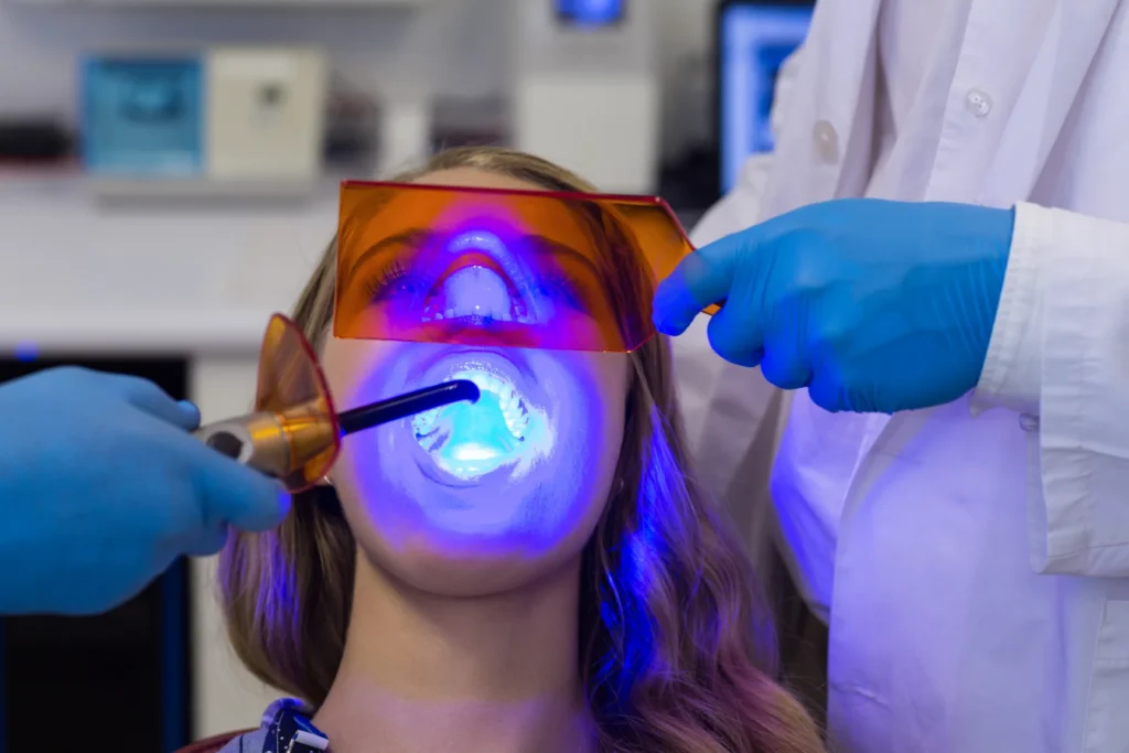 blanqueamiento dental grecia alajuela