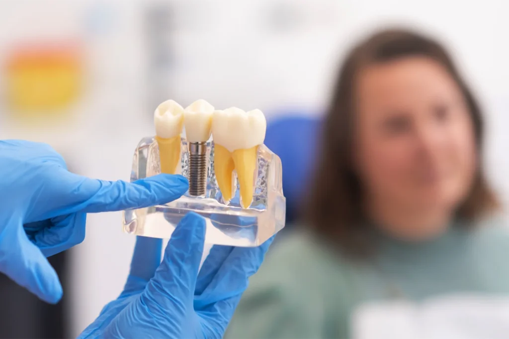 implantes dentales grecia alajuela